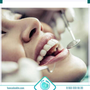 Mode Dental İmplant