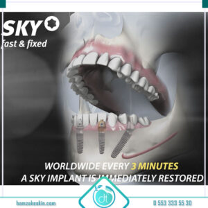 SKY İmplant